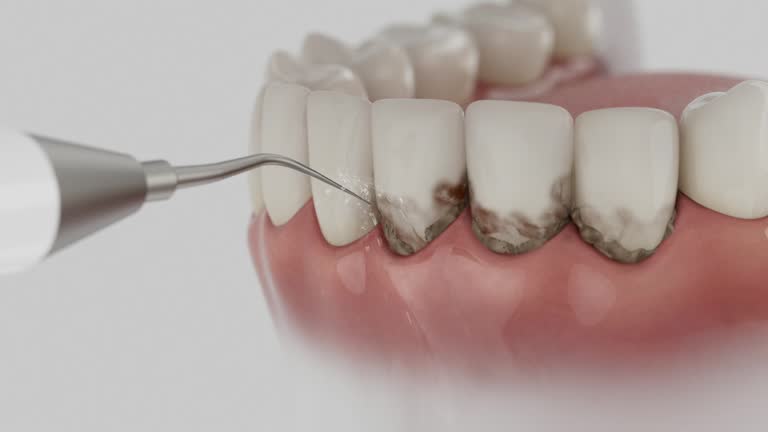 Trusted Dental Implants service in Algonac, MI - Dentist Open Now